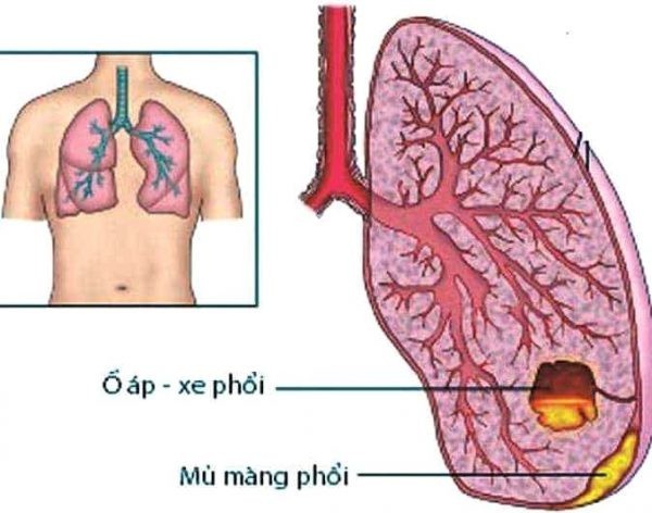 Hoa phù dung thanh nhiệt, giải độc