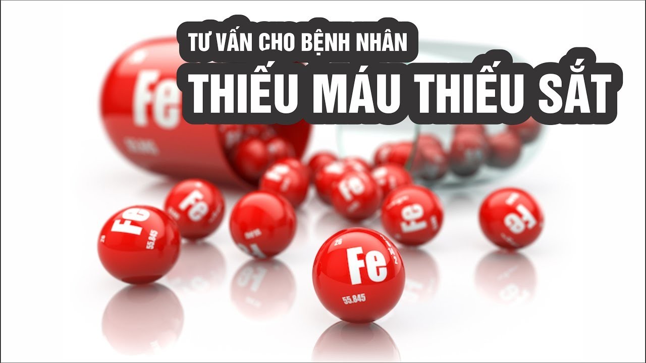 5 triệu chứng xảy ra khi bị thiếu máu do thiếu sắt cần cảnh giác