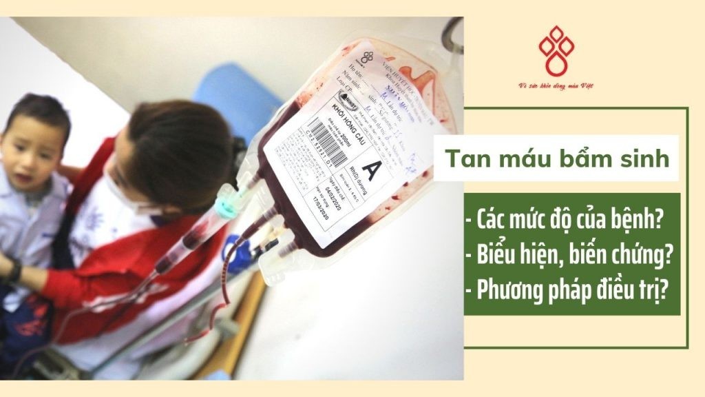 Bệnh tan máu bẩm sinh và những biểu hiện, biến chứng cần lưu ý